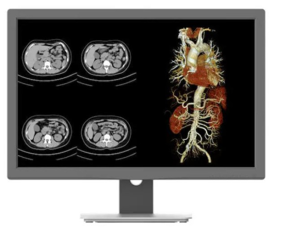фото Монитор 24" Jusha JUSHA-CR240G в Волгограде