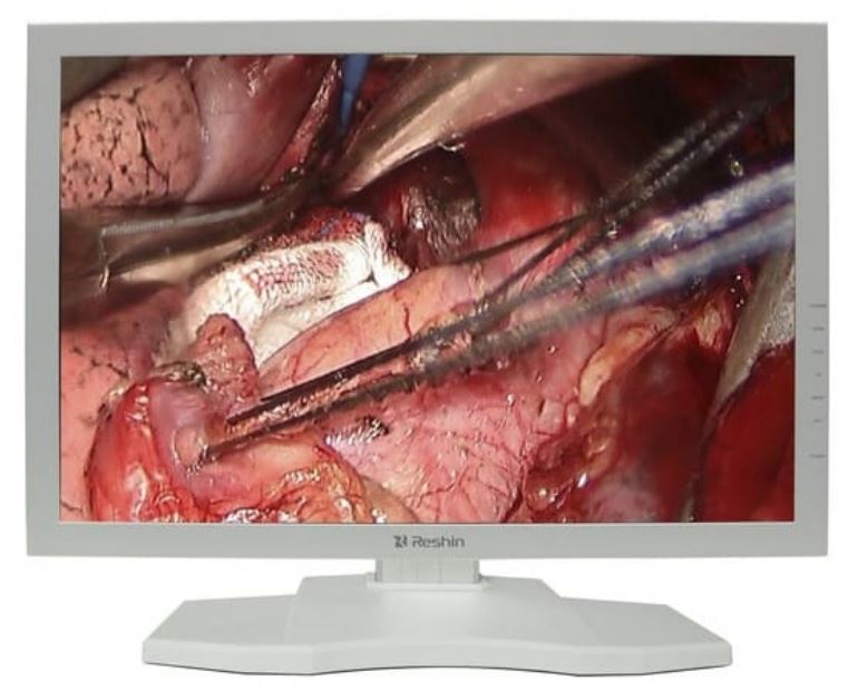 

Монитор 24" RESHIN MS247SA 1920x1200, наличие РУ, MS247SA