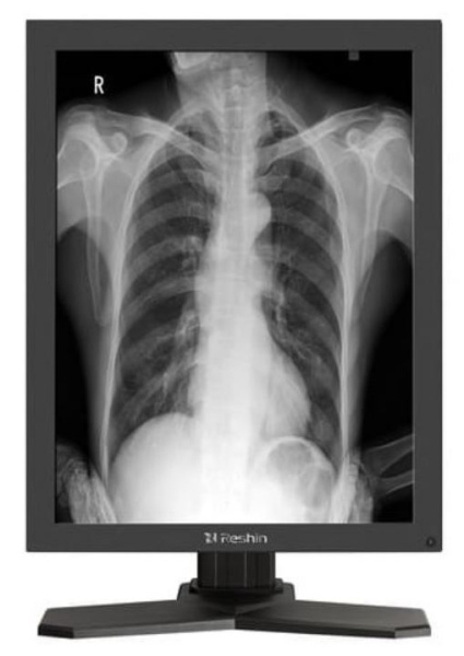 фото Монитор 21,3"  MD26GA в Самаре