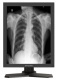 фото Монитор 21,3"  MD26GA в Уфе