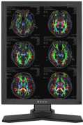 фото Монитор  MD32C